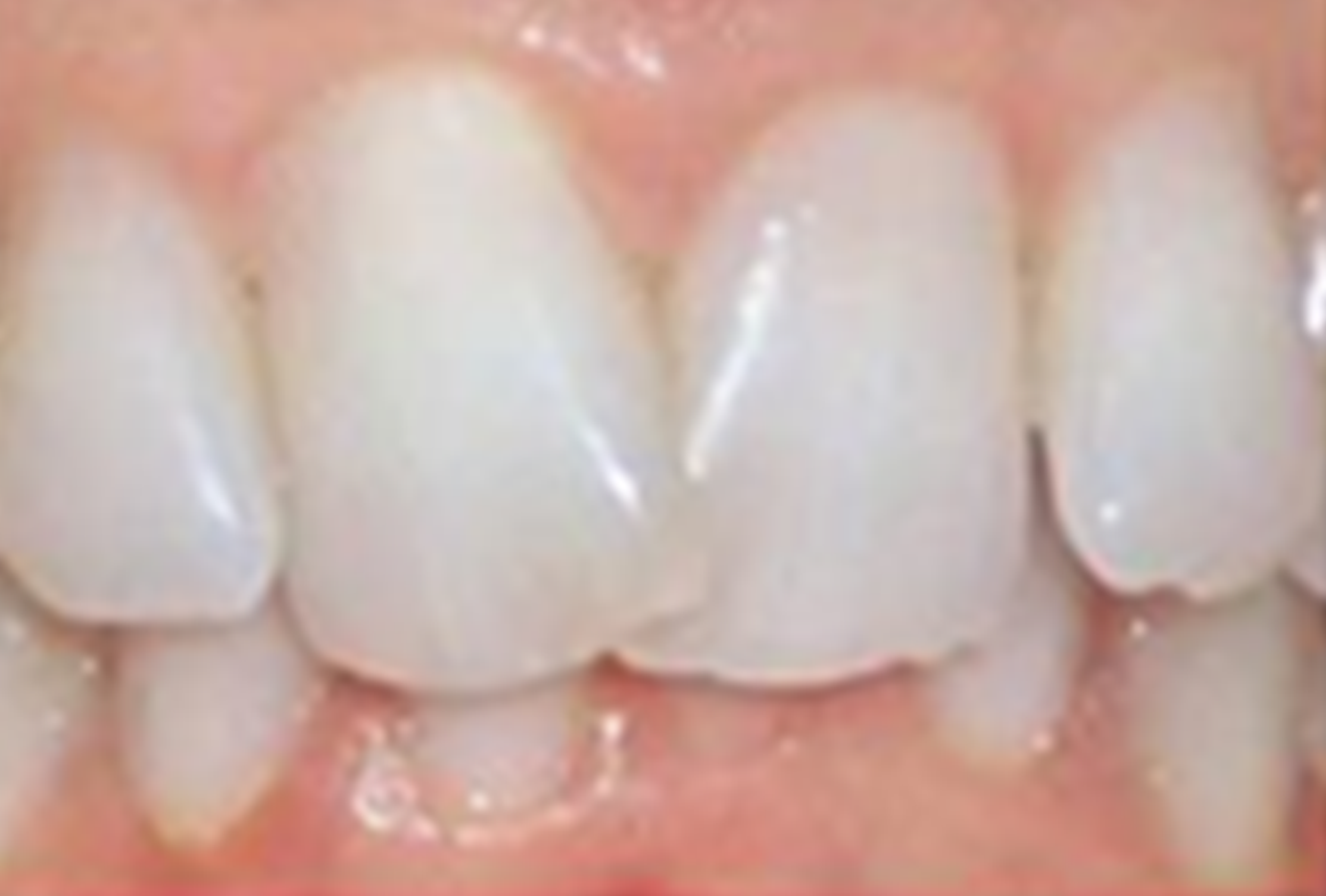 before treatment