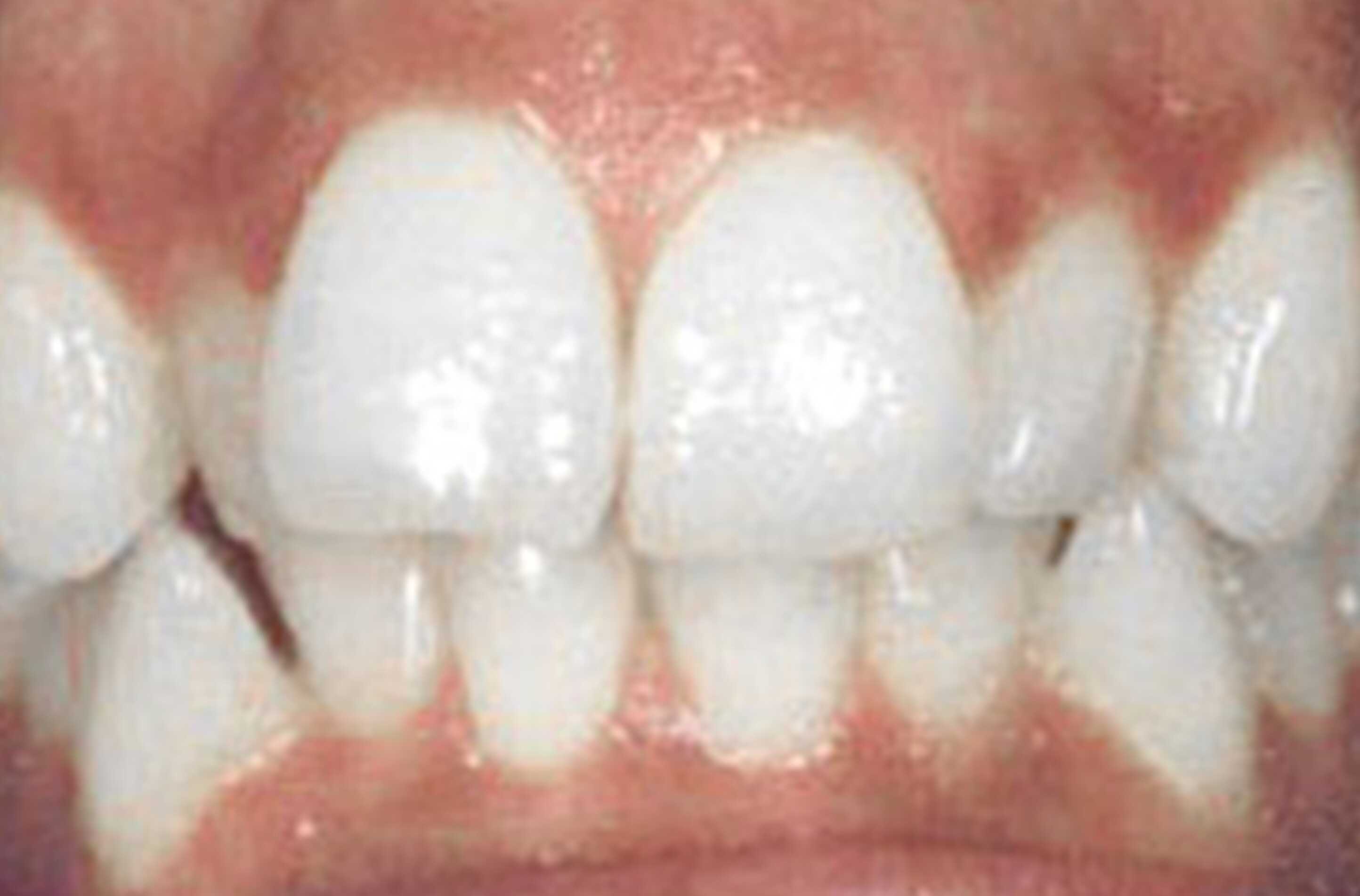 before treatment