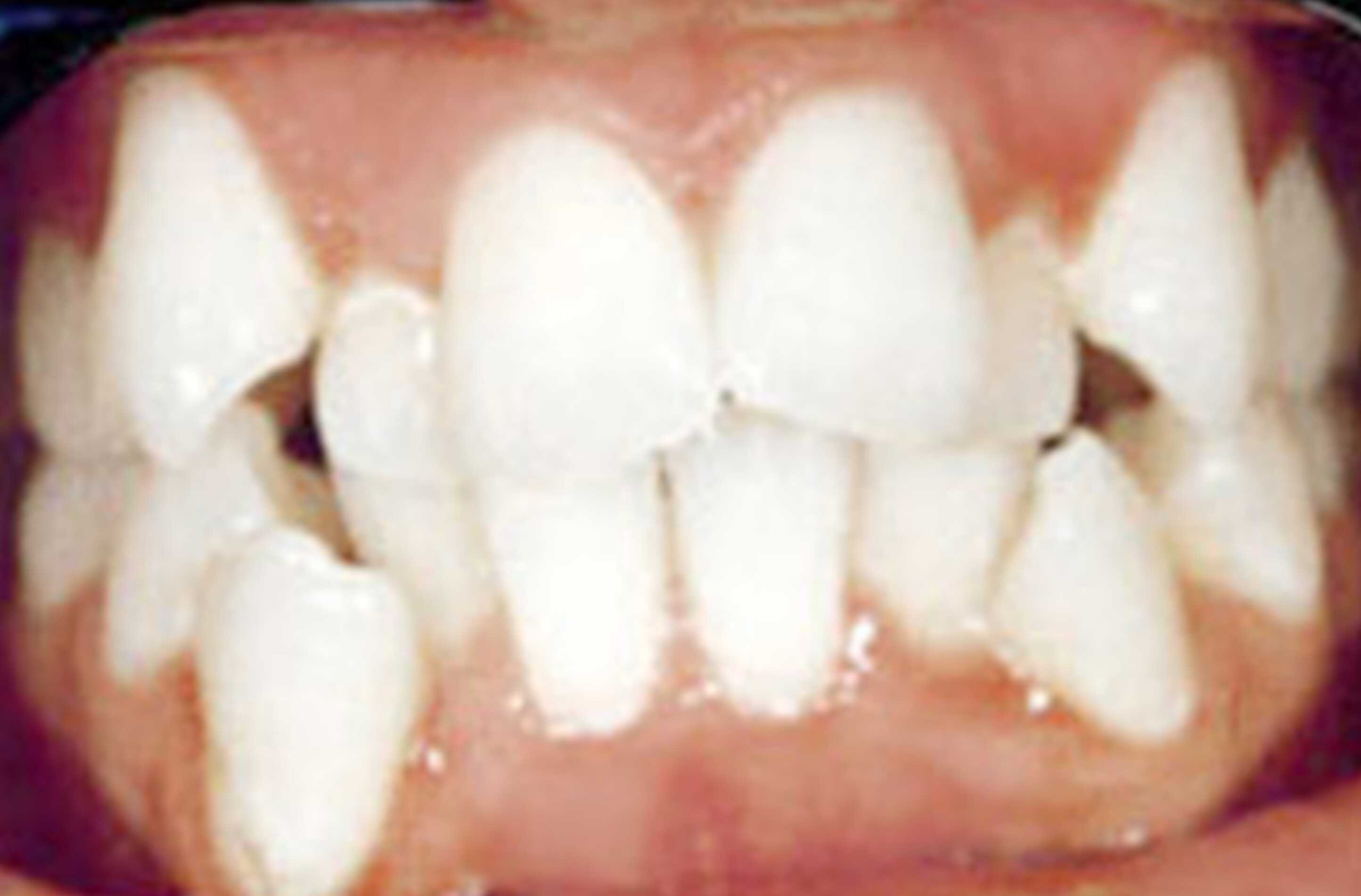 before treatment