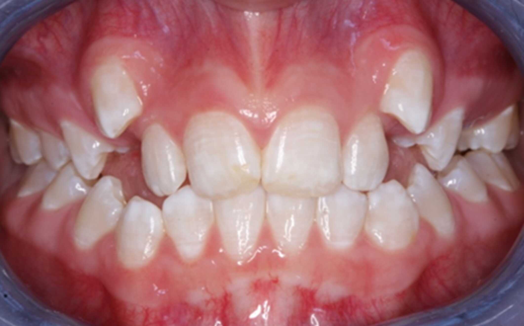 before treatment